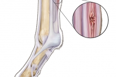 Equine Tendon Injury